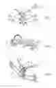 Fig. 02 - Prosthetic sternum device with manubrium