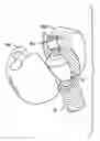 Fig. 01 - Dental / Prosthetic Implant
