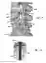 Fig. 06 - Dental / Prosthetic Implant