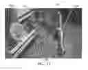 Fig. 09 - Dental / Prosthetic Implant