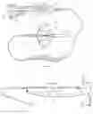 Fig. 01 - Method and apparatus for inflating and deflating balloon catheters