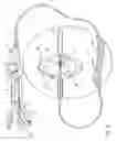 Fig. 02 - Method and apparatus for inflating and deflating balloon catheters
