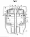 Fig. 07 - Anastomosis device with collapsible distal head element