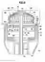 Fig. 09 - Anastomosis device with collapsible distal head element