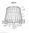 Fig. 15 - Anastomosis device with collapsible distal head element