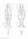 Fig. 08 - RADIOFREQUENCY BALLOON CATHETER SYSTEM