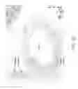 Fig. 52 - Methods and apparatuses for remodeling tissue of or adjacent to a body passage