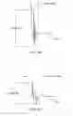 Fig. 55 - Methods and apparatuses for remodeling tissue of or adjacent to a body passage