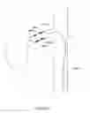 Fig. 60 - Methods and apparatuses for remodeling tissue of or adjacent to a body passage