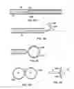 Fig. 12 - Catheter with distal section having side-by-side loops