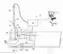 Fig. 01 - System and method of using an endoscopic catheter as a port in laparoscopic surgery