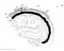 Fig. 01 - NOVEL ROBOTIC SURGICAL DEVICE