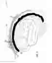 Fig. 03 - NOVEL ROBOTIC SURGICAL DEVICE