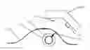Fig. 01 - IMPLANT FOR TARGETING THERAPEUTIC PROCEDURE