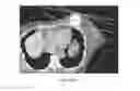 Fig. 05 - IMPLANT FOR TARGETING THERAPEUTIC PROCEDURE