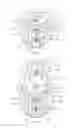 Fig. 06 - Multi-piece abutment and digital method for preparation of a dental implant surgical site for the promotion of a desired emergent sulcus