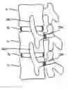 Fig. 01 - Flexible anchoring and fusion devices and methods of using the same