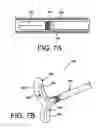Fig. 06 - Flexible anchoring and fusion devices and methods of using the same