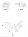 Fig. 02 - Sterile implant instruments and kits for flexible joint implants