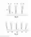 Fig. 09 - Lower limb prosthesis comprising a hydraulic damping and a vacuum generating mechanism
