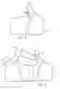 Fig. 04 - Joint stabilizing orthopedic device