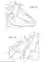 Fig. 08 - Joint stabilizing orthopedic device