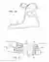 Fig. 10 - Joint stabilizing orthopedic device