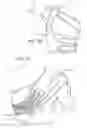 Fig. 15 - Joint stabilizing orthopedic device