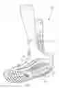 Fig. 02 - SHOCK ABSORBER INSERT FOR AN ORTHOPEDIC WALKING BOOT