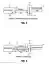 Fig. 02 - Method and apparatus for providing percussive ventilation therapy to a patient airway