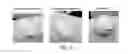 Fig. 02 - MOUSSE-TYPE COSMETIC COMPOSITION CONTAINING SCORIA