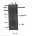 Fig. 06 - METHODS FOR ATTENUATING RELEASE OF INFLAMMATORY MEDIATORS AND PEPTIDES USEFUL THEREIN