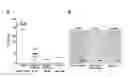 Fig. 01 - METHOD OF TREATING A LOCALIZED FIBROTIC DISORDER USING A TNF RECEPTOR 2 ANTAGONIST