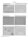 Fig. 07 - METHOD OF TREATING A LOCALIZED FIBROTIC DISORDER USING A TNF RECEPTOR 2 ANTAGONIST