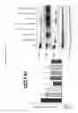 Fig. 35 - METHOD OF TREATING A LOCALIZED FIBROTIC DISORDER USING A TNF RECEPTOR 2 ANTAGONIST