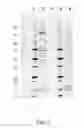 Fig. 02 - CHIMERIC VSV-G PROTEINS AS NUCLEIC ACID TRANSFER VEHICLES