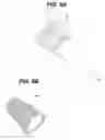 Fig. 07 - Ultraviolet disinfection case