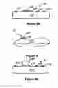 Fig. 06 - Remote-Controlled Medicine Delivery System