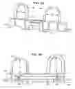Fig. 07 - Interventional catheter assemblies, control consoles and adaptive tubing cassettes
