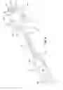 Fig. 06 - Medicament delivery device