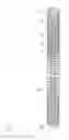 Fig. 02 - Vascular embolization device and production method therefor