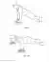 Fig. 10 - ROLLING, MULTI-DIRECTIONAL FITNESS DEVICE