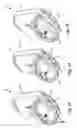 Fig. 20 - Air treatment system