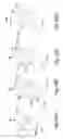 Fig. 44 - Air treatment system