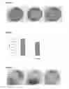 Fig. 07 - MICROPARTICLES