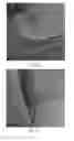 Fig. 09 - Method for degrading an organic material and method for sterilizing