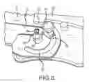 Fig. 07 - Folding knife with replaceable blade