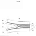 Fig. 07 - Bonded structure