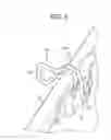 Fig. 06 - Vehicle seat