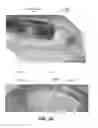 Fig. 08 - Pill feeder